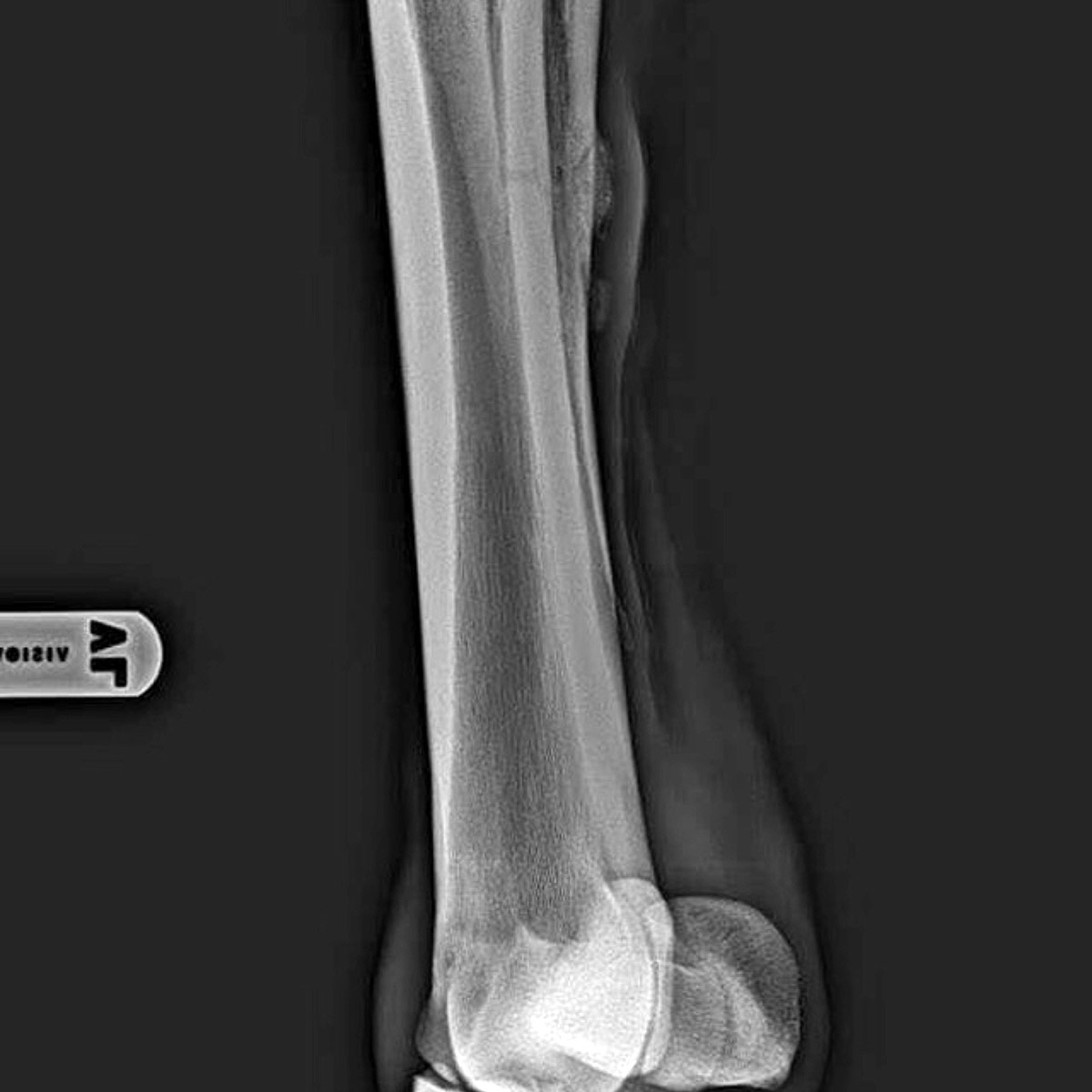 Eddi’s Splint Bone Fracture HorseDVM